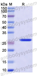 Recombinant Human ANO1 Protein, N-His