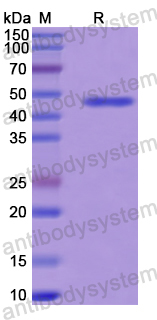 Recombinant Human SUPT16H Protein, N-His