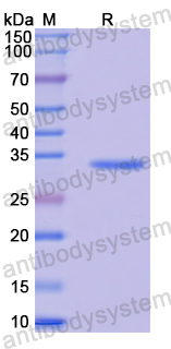 Recombinant Human MIXL1 Protein, N-GST & C-His