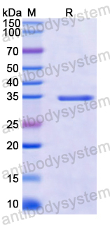 Recombinant Human CDCA2 Protein, N-GST & C-His