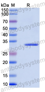 Recombinant Human MTHFD1L Protein, N-His