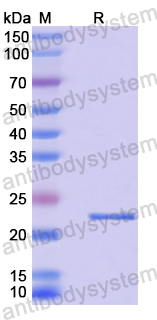 Recombinant Human DYNLL2 Protein, N-His-SUMO
