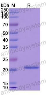 Recombinant Human KCNE4 Protein, N-His-SUMO