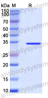Recombinant Human CEP131 Protein, N-His