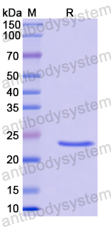 Recombinant Human CEP112 Protein, N-His-SUMO