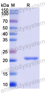 Recombinant Human SGMS1 Protein, N-His-SUMO