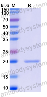 Recombinant Human AUTS2 Protein, N-His-SUMO