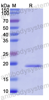 Recombinant Human SOX13 Protein, N-His-SUMO