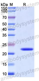 Recombinant Human ACBD5 Protein, N-His