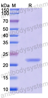 Recombinant Human ARL5B Protein, N-His