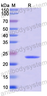 Recombinant Human ESRP1 Protein, N-His