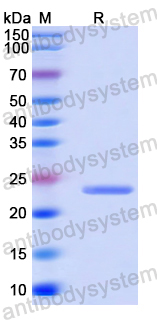 Recombinant Human CRACR2A Protein, N-His