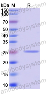 Recombinant Human GSDMB Protein, N-His
