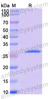 Recombinant Human GFM1 Protein, N-His