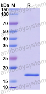Recombinant Human AFAP1L2 Protein, N-His