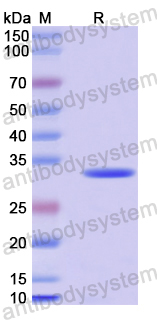 Recombinant Human B4GALT6 Protein, N-His