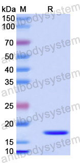 Recombinant Human CEP19 Protein, N-His