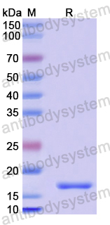 Recombinant Human CDCA7 Protein, N-His