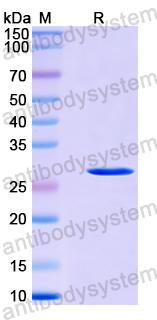 Recombinant Human ANKRD27 Protein, N-His