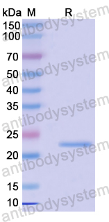 Recombinant Human COQ5 Protein, N-His-SUMO