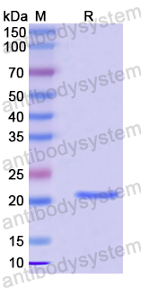 Recombinant Human MTIF3 Protein, N-His