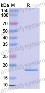 Recombinant Human YEATS2 Protein, N-His