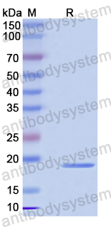 Recombinant Human OTUD6A Protein, N-His