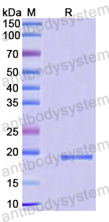 Recombinant Human ZC3H12D Protein, N-His