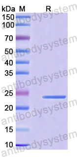 Recombinant Human IFT43 Protein, N-His-SUMO