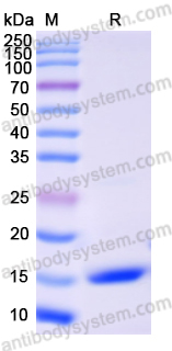 Recombinant Human SEZ6L2 Protein, N-His