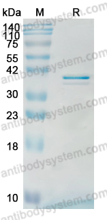 Recombinant Human ATAD1 Protein, N-His