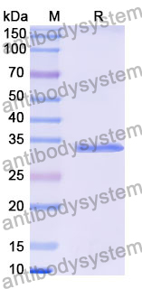 Recombinant Human PRRT1 Protein, N-GST & C-His