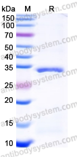 Recombinant Human GGH Protein, N-His