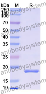 Recombinant Human JADE1 Protein, N-His