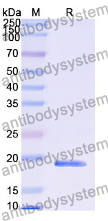 Recombinant Human FGD5 Protein, N-His
