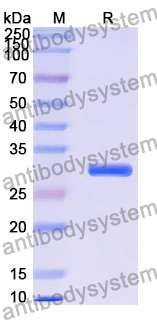 Recombinant Human PDSS2 Protein, N-His