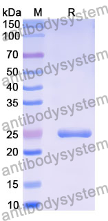 Recombinant Human ERC1 Protein, N-His-SUMO