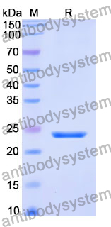 Recombinant Human AHNAK2 Protein, N-His-SUMO