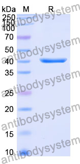 Recombinant Human TPH2 Protein, N-His