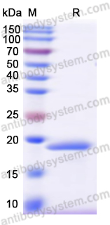 Recombinant Human SYCP3 Protein, N-His