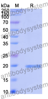 Recombinant Human VPS8 Protein, N-His