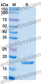 Recombinant Human AFAP1 Protein, N-His