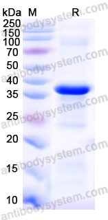 Recombinant Human CGAS Protein, N-His