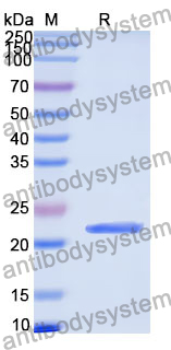 Recombinant Human MCPH1 Protein, N-His