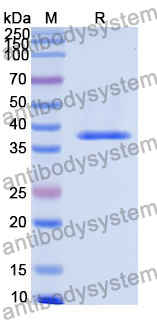 Recombinant Human SLC30A7 Protein, N-GST & C-His