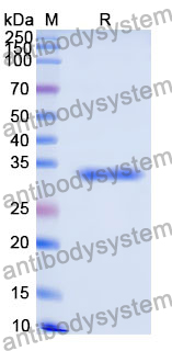 Recombinant Human NEIL3 Protein, N-His