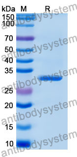 Recombinant Human UBASH3B Protein, N-His