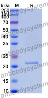 Recombinant Human PHLDA1 Protein, N-His
