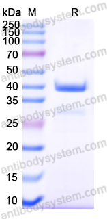 Recombinant Human NINJ1 Protein, N-GST & C-His