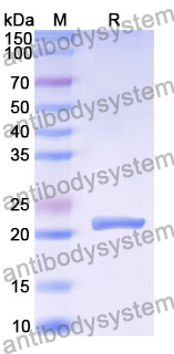 Recombinant Human RAB3C Protein, N-His